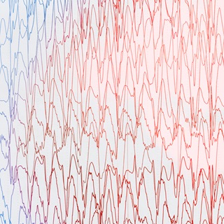 focal-resection-1290x1290